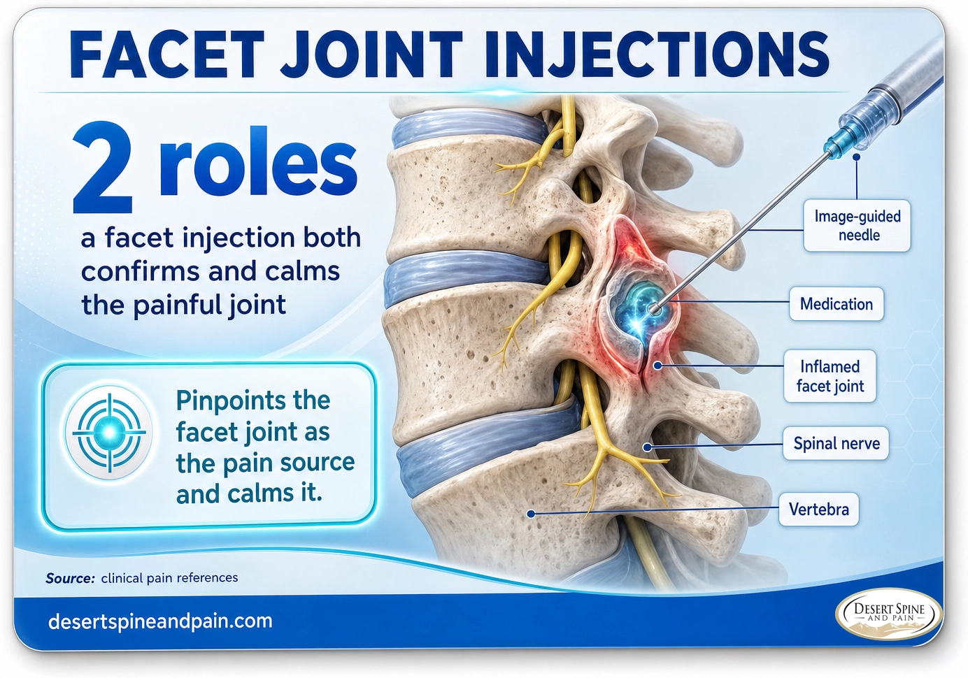 Facet joint injections: an image-guided injection that both confirms the facet joint as the pain source and calms the inflammation