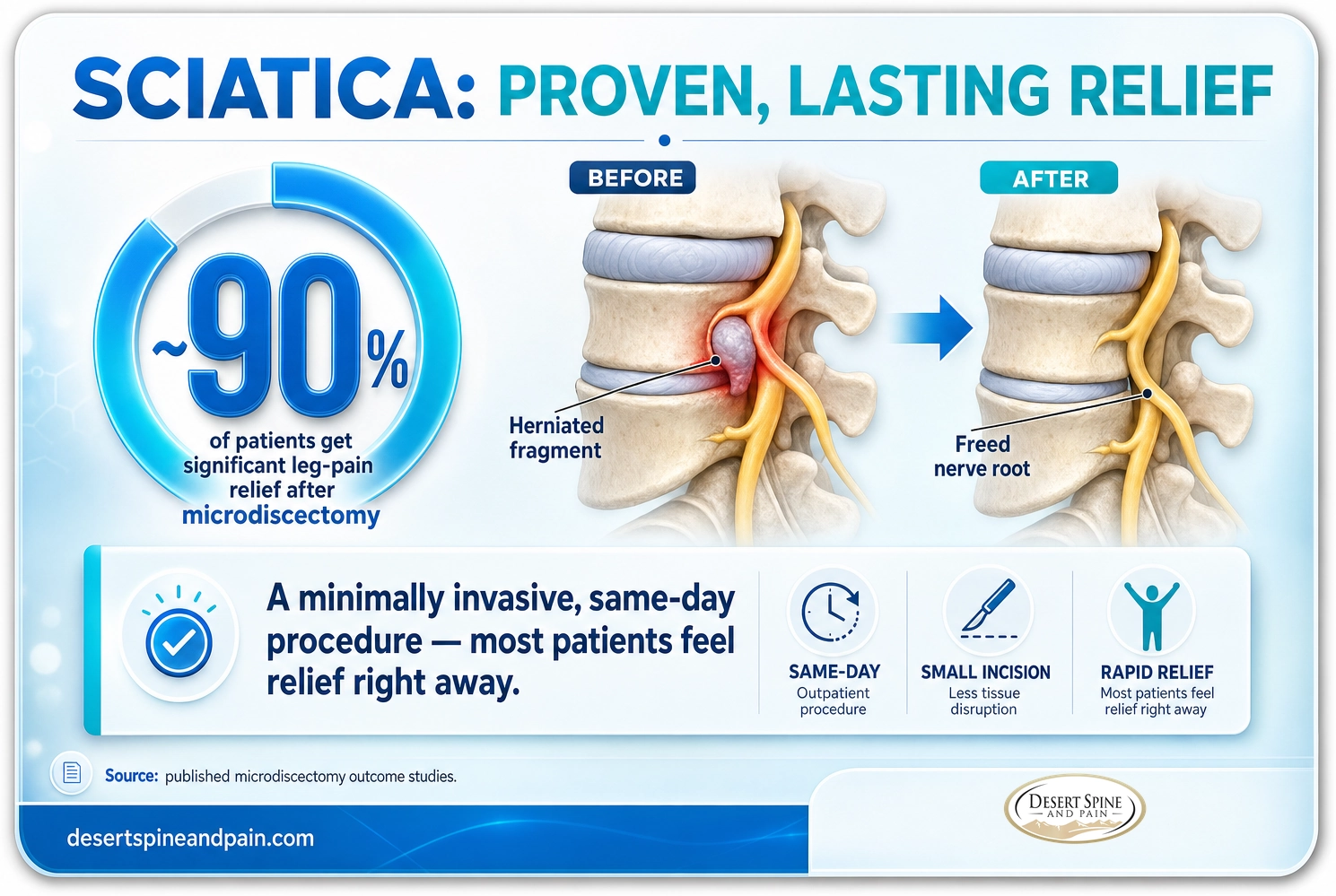 Sciatica: about 90 percent of patients get significant leg-pain relief after microdiscectomy