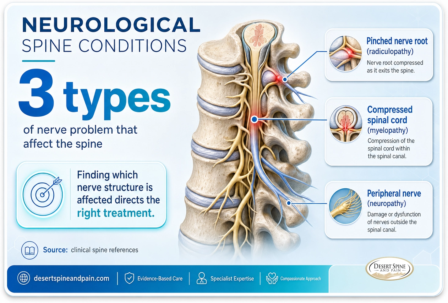Neurological spine conditions: radiculopathy (pinched nerve root), myelopathy (compressed cord), and neuropathy (peripheral nerve)