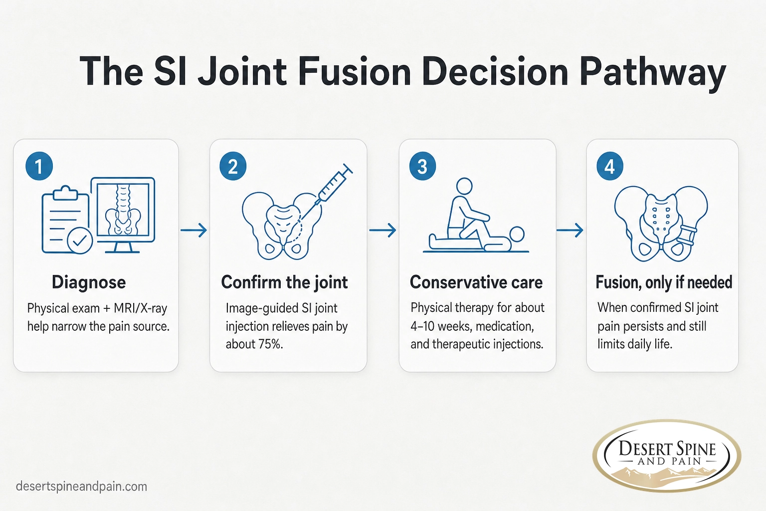 Four-step pathway showing how doctors decide when SI joint fusion is necessary