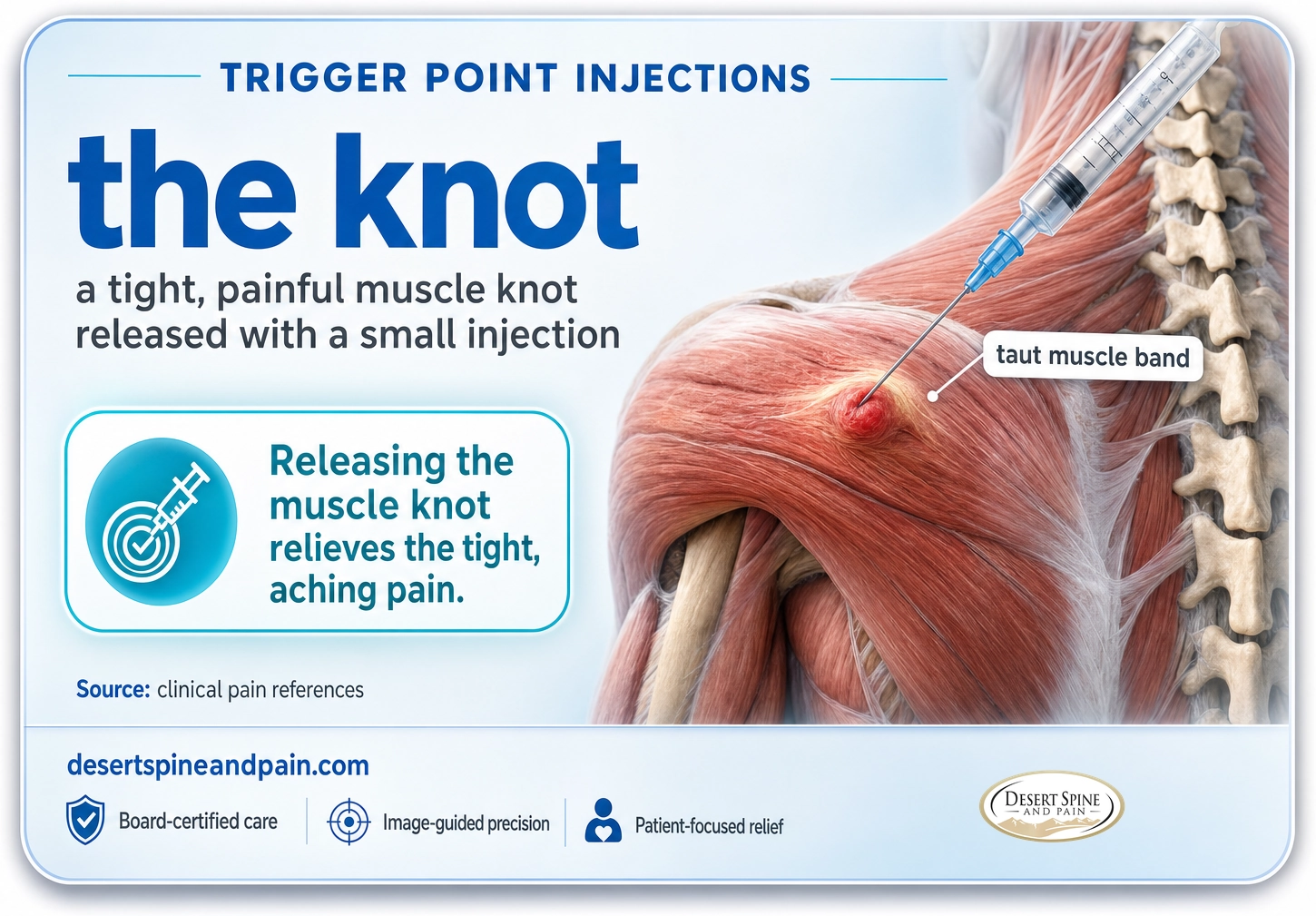 Trigger point injections: a small injection that releases a tight, painful muscle knot and relieves the aching