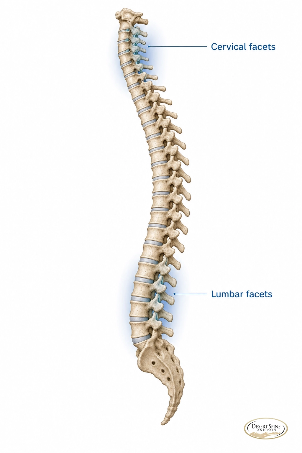 Spine diagram labeling the cervical facets and lumbar facets most affected by facet disease