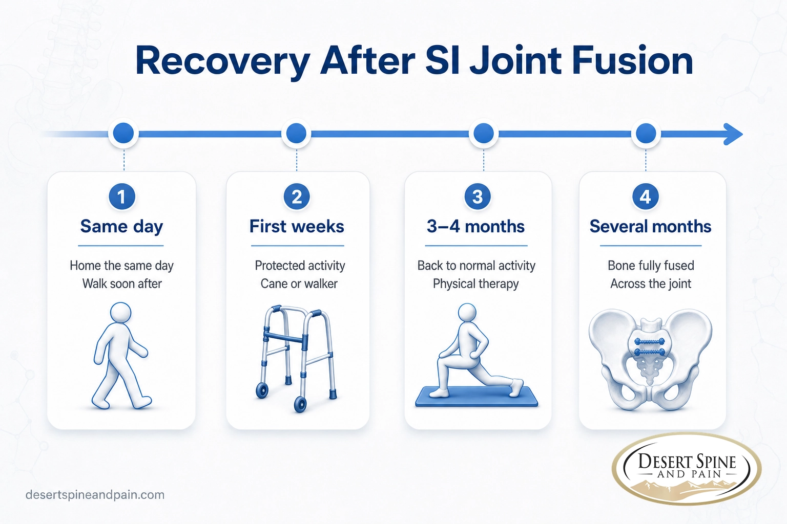 Recovery timeline after SI joint fusion from same-day discharge to full bone fusion over several months Recovery timeline after SI joint fusion from same-day discharge to full bone fusion over several months