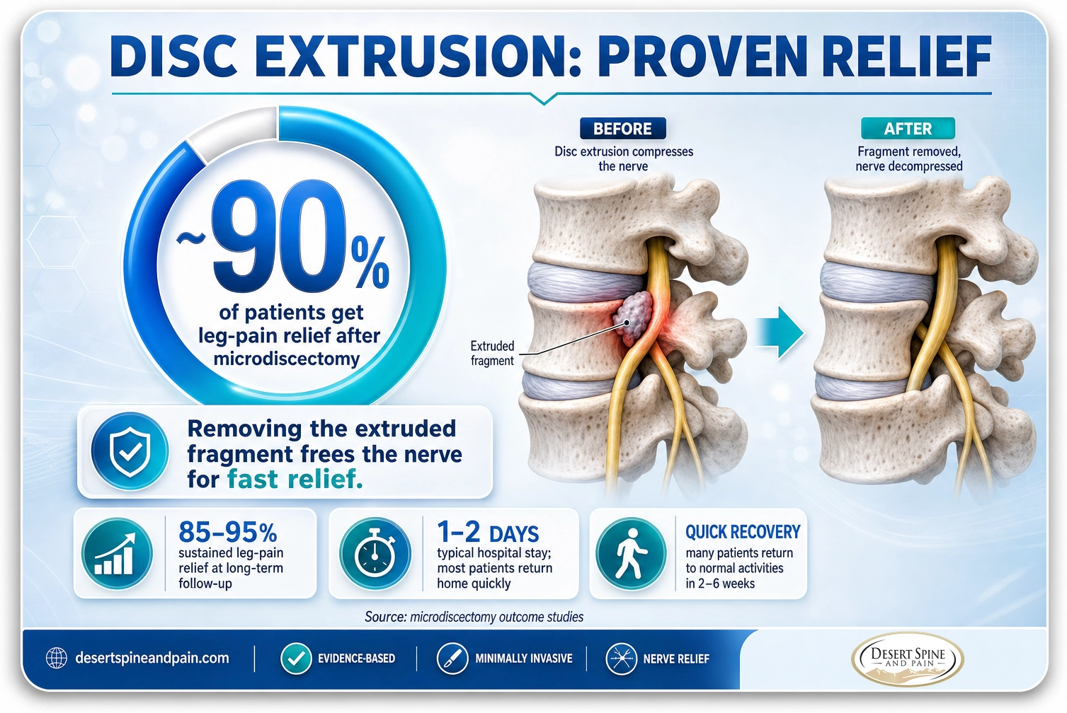 Disc extrusion: about 90 percent of patients get leg-pain relief after microdiscectomy