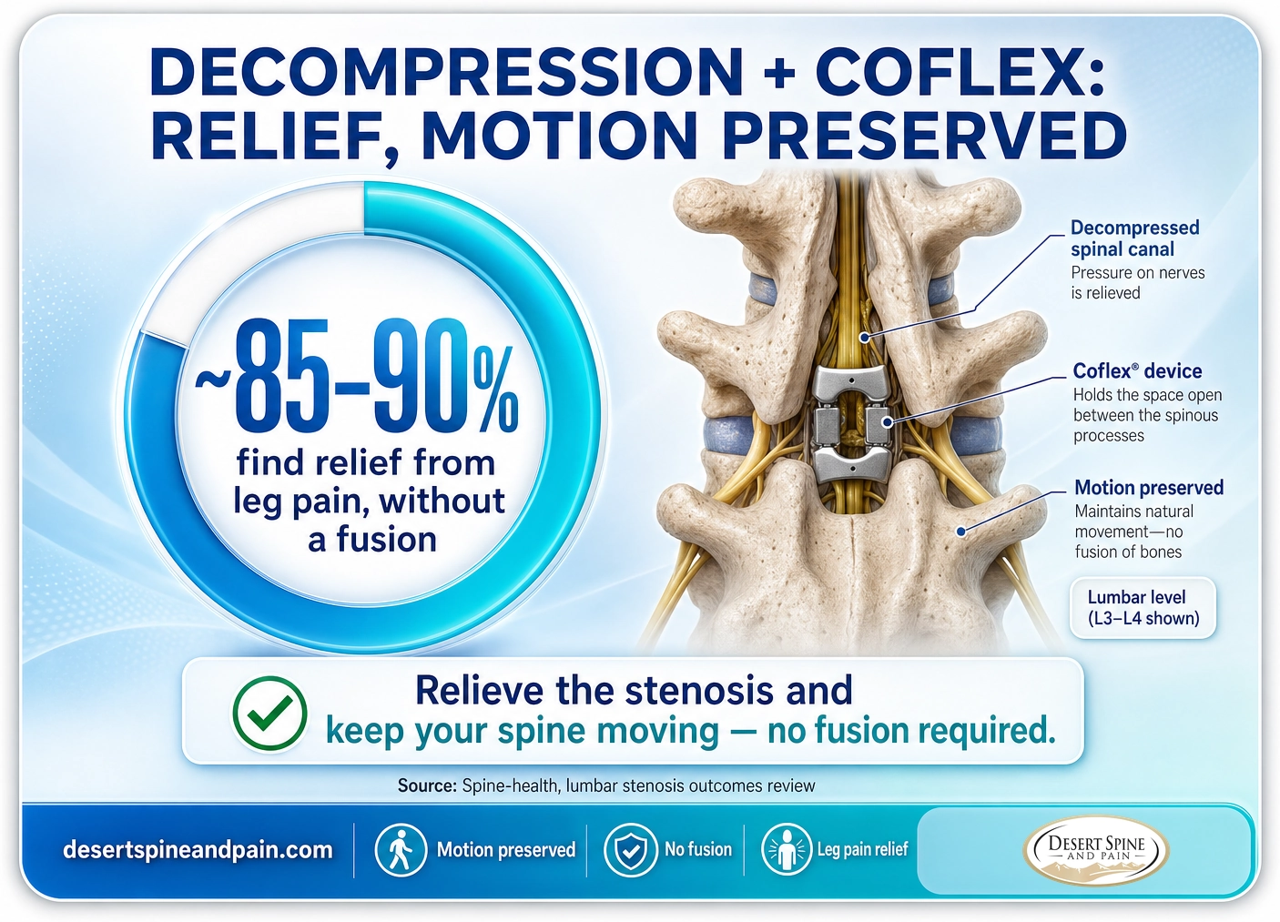 Decompression with Coflex: about 85 to 90 percent find relief from leg pain without a fusion