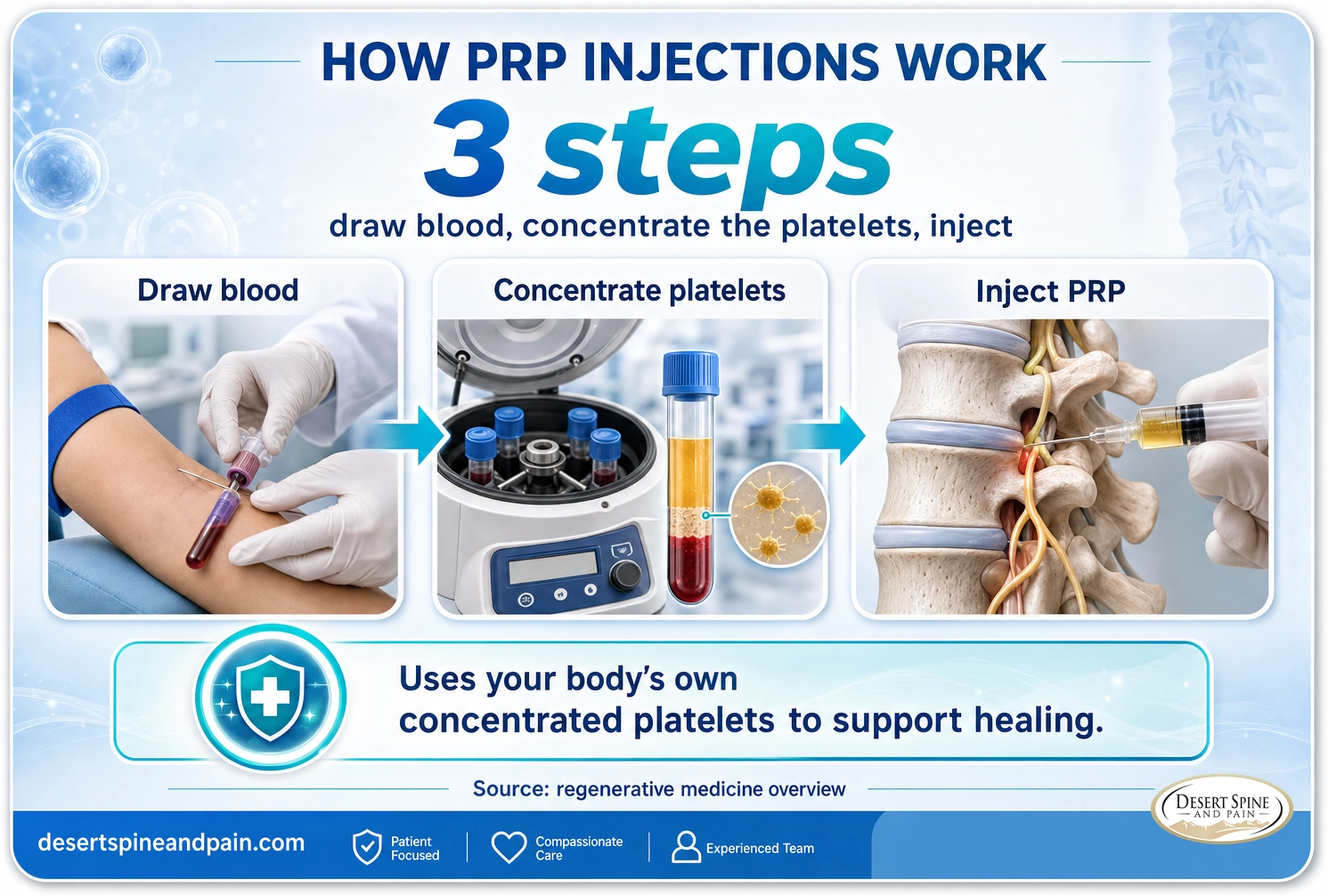 PRP injections: blood is drawn, spun to concentrate platelets, then the platelet-rich plasma is injected to support healing