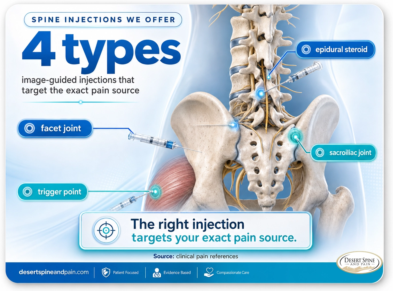 Spine injections: epidural steroid, facet joint, sacroiliac joint, and trigger point injections that target the exact pain source