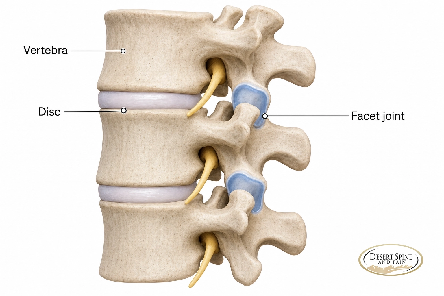 Labeled side-view diagram of lumbar vertebrae showing the vertebra, disc and facet joint