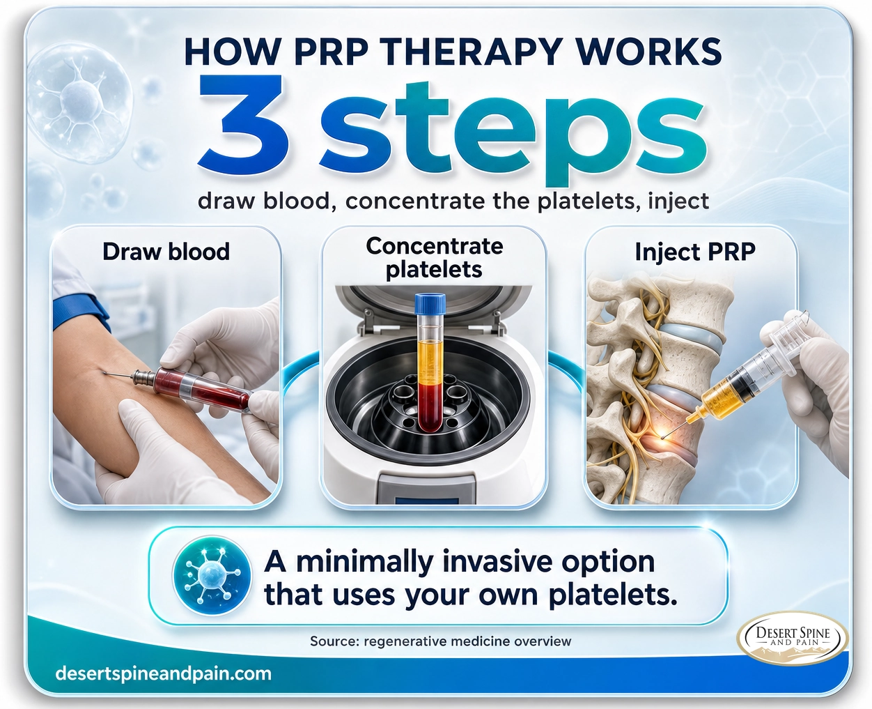 PRP therapy: a minimally invasive regenerative option in which your own blood is concentrated into platelet-rich plasma and injected
