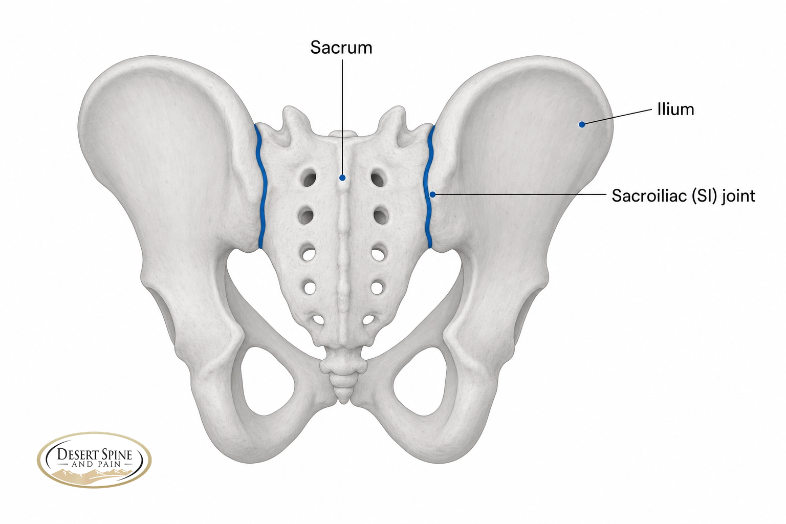 Posterior pelvis diagram labeling the sacrum, ilium, and the sacroiliac (SI) joint between them