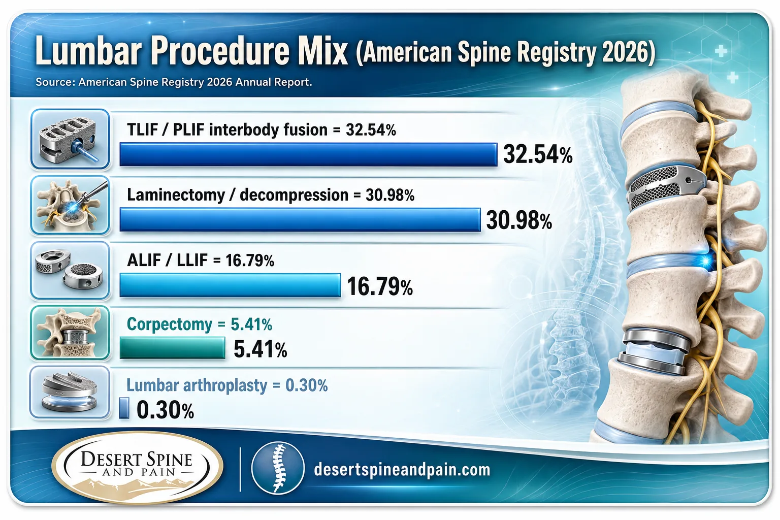 Bar chart of lumbar procedure mix from the American Spine Registry 2026 including TLIF PLIF and ALIF LLIF Bar chart of lumbar procedure mix from the American Spine Registry 2026 including TLIF PLIF and ALIF LLIF