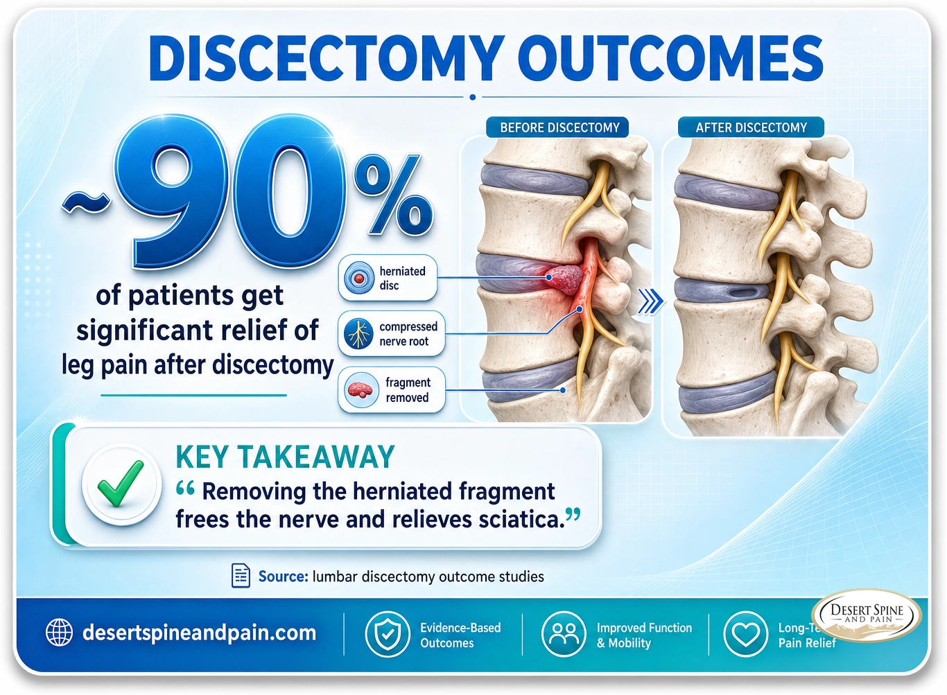 Discectomy: about 90 percent of patients get significant relief of leg pain