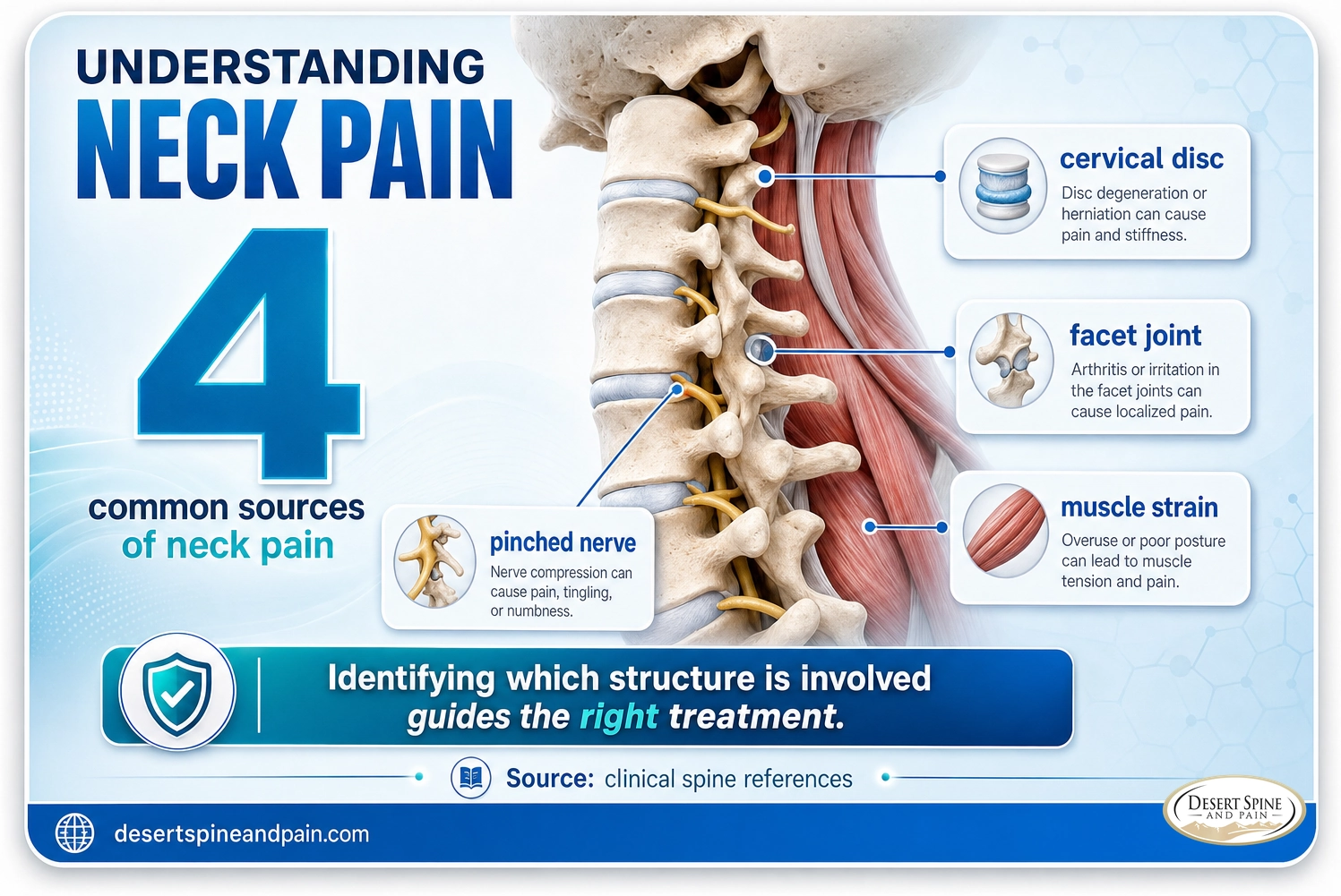 Neck pain: the four common sources are the cervical disc, facet joint, pinched nerve, and muscle strain