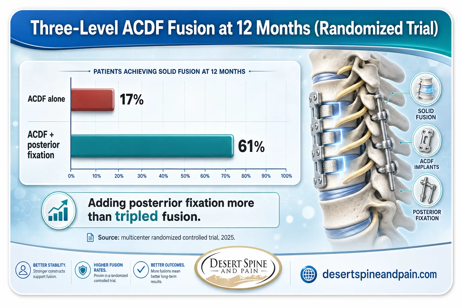 Bar chart showing three-level ACDF fusion 17 percent alone versus 61 percent with posterior fixation