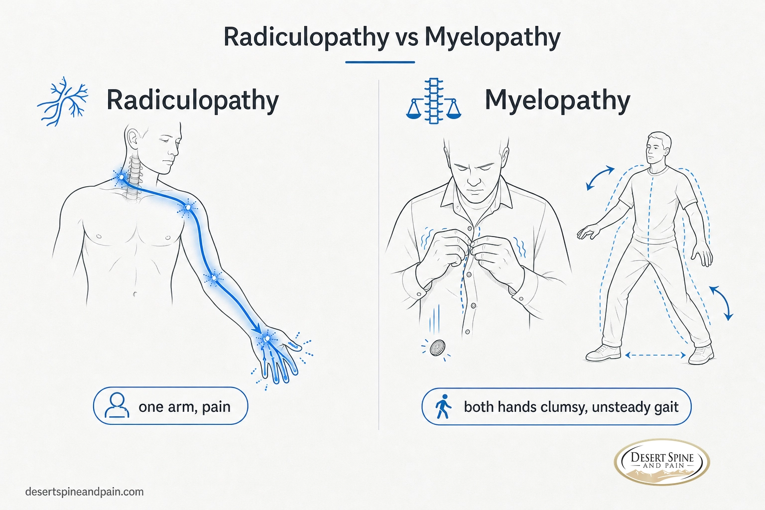 Infographic comparing one-sided arm pain in cervical radiculopathy with clumsy hands and unsteady gait in cervical myelopathy