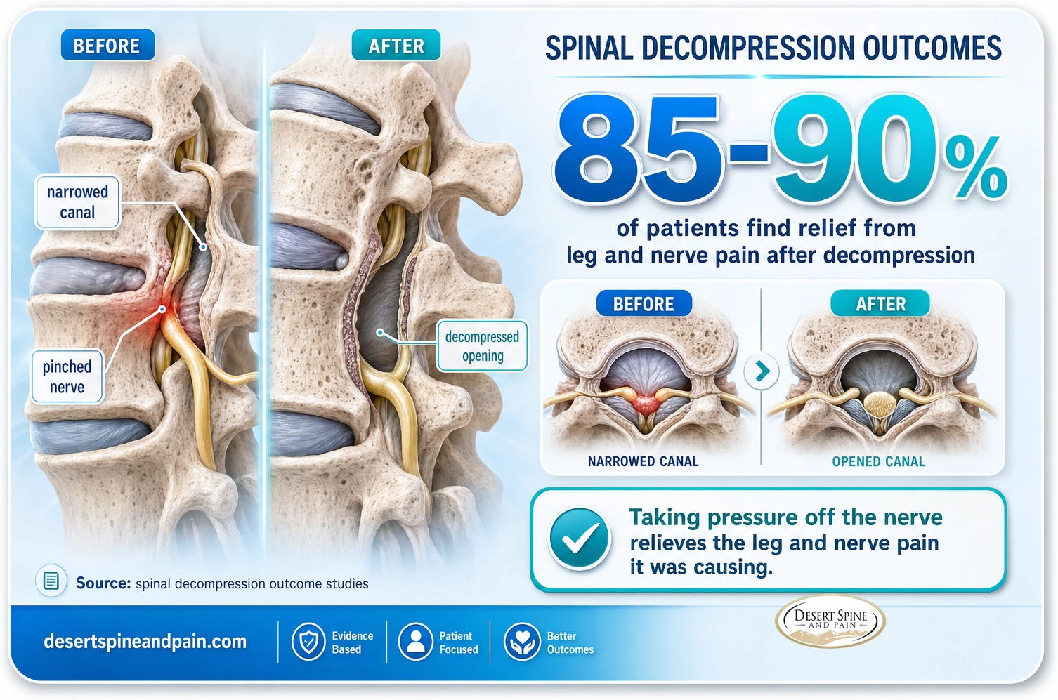 Spinal decompression: about 85 to 90 percent of patients find relief from leg and nerve pain