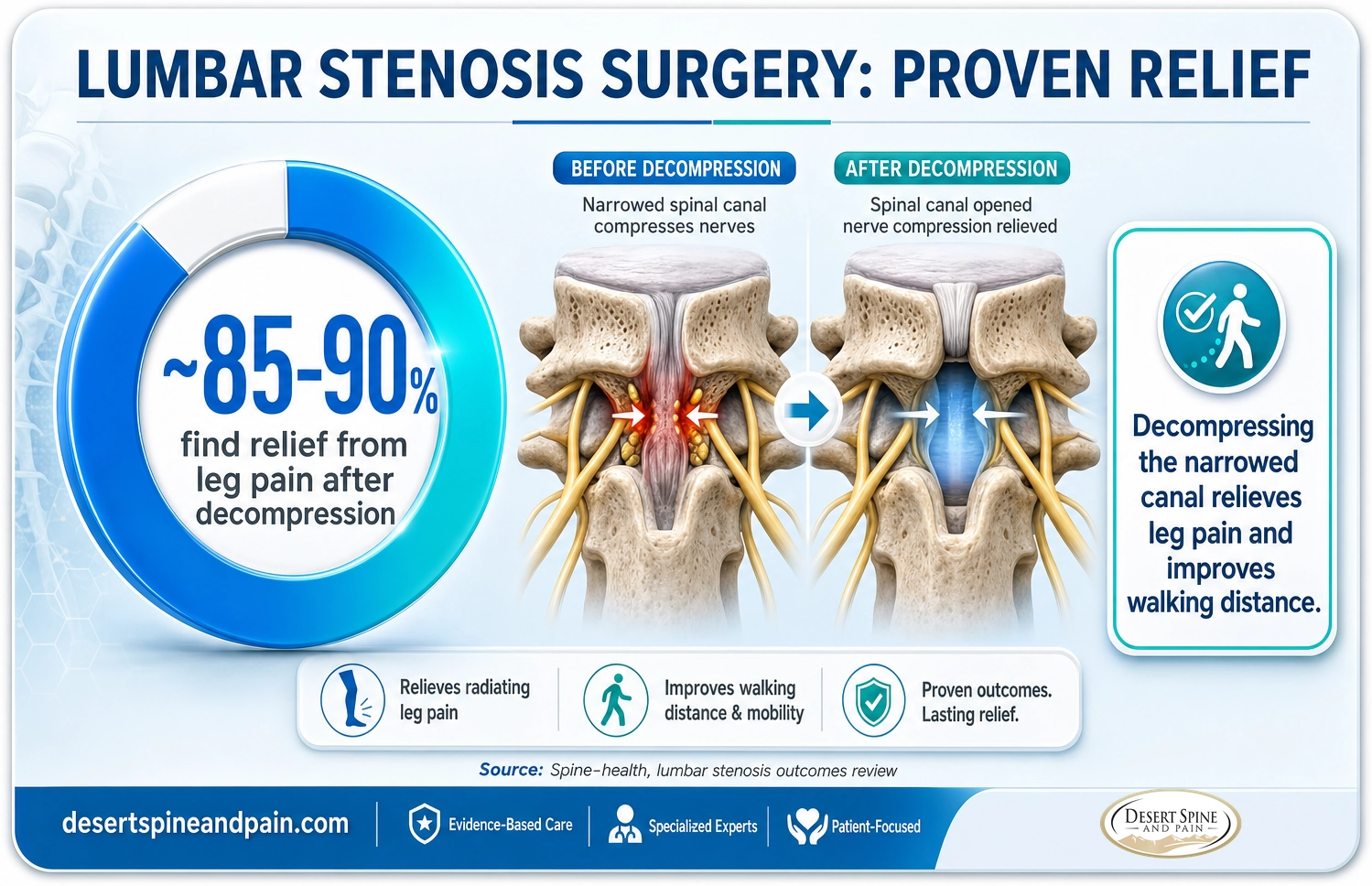 Lumbar stenosis surgery: about 85 to 90 percent find relief from leg pain after decompression