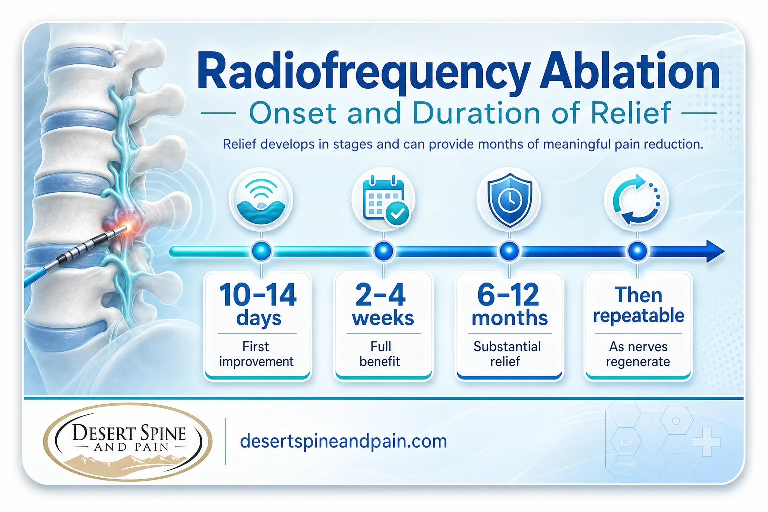 Timeline infographic showing RFA relief starting in 10-14 days and lasting 6-12 months before it can be repeated Timeline infographic showing RFA relief starting in 10-14 days and lasting 6-12 months before it can be repeated