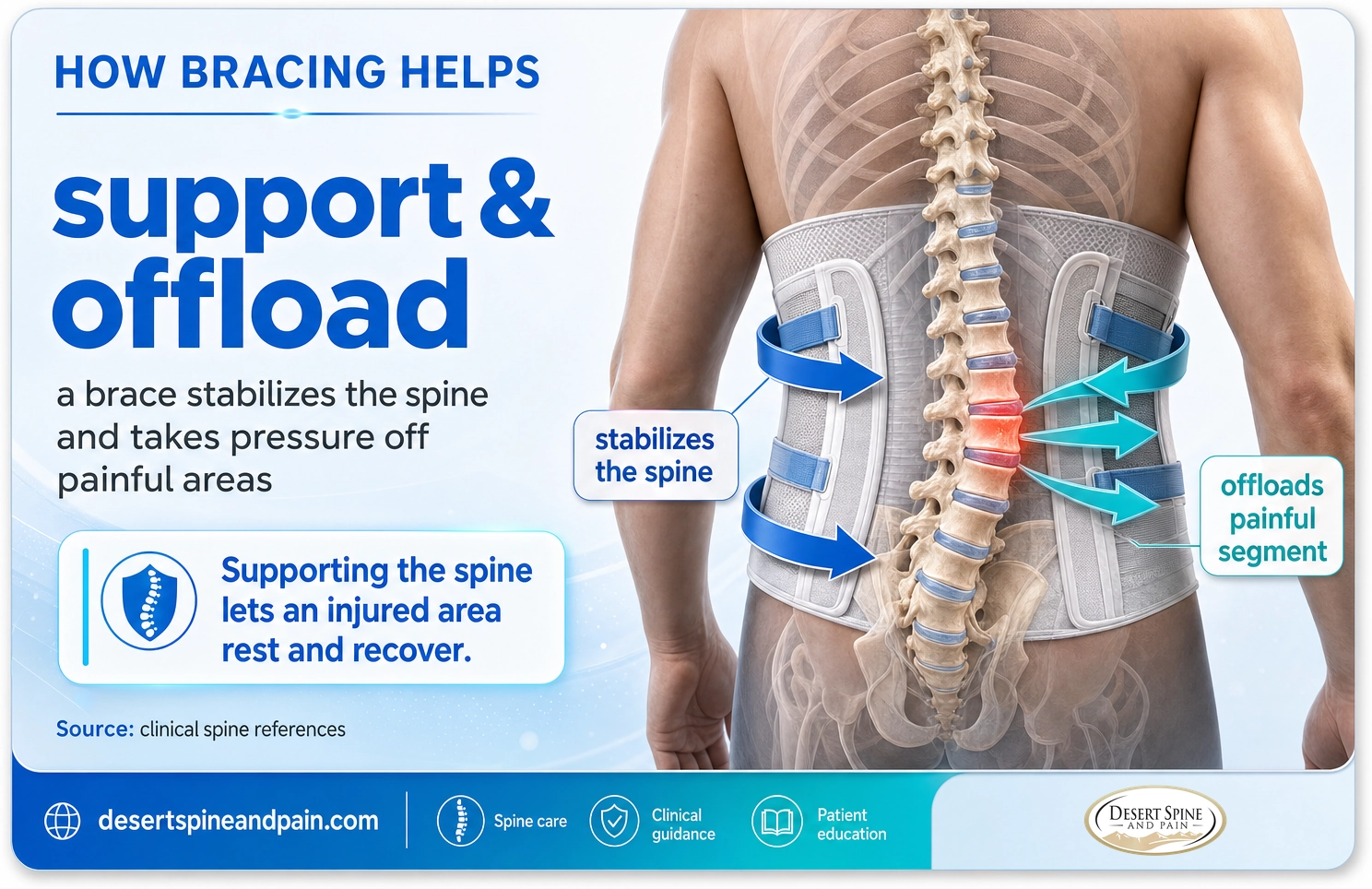 Bracing: a support that stabilizes the spine and offloads the painful segment so an injured area can rest and recover