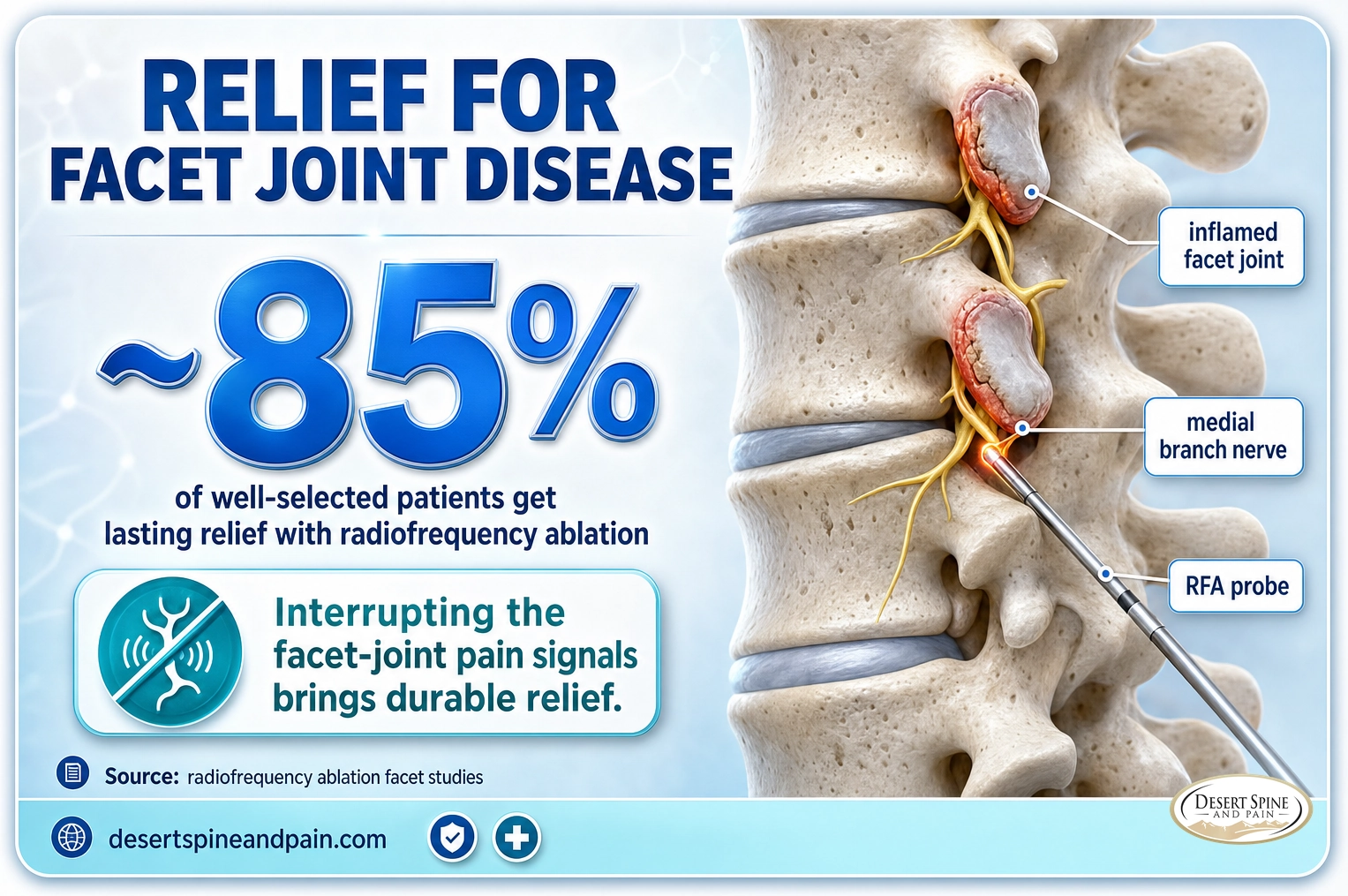 Facet joint disease: about 85 percent of well-selected patients get lasting relief with radiofrequency ablation