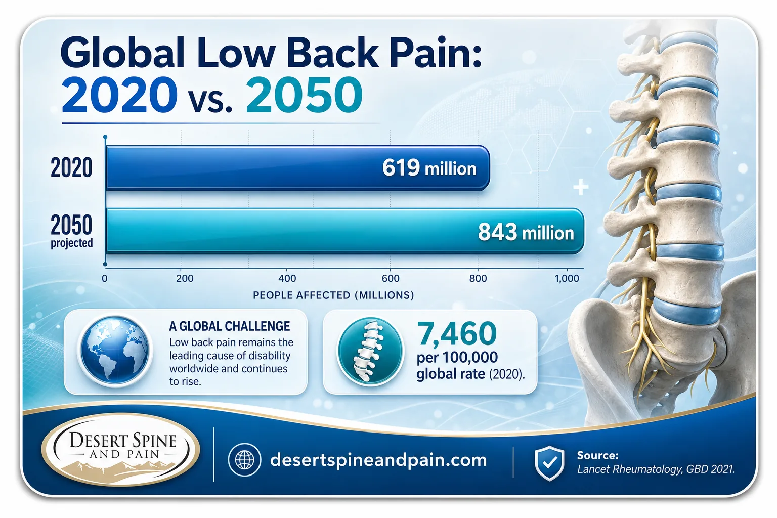 Bar chart of global low back pain cases rising from 619 million in 2020 to 843 million by 2050