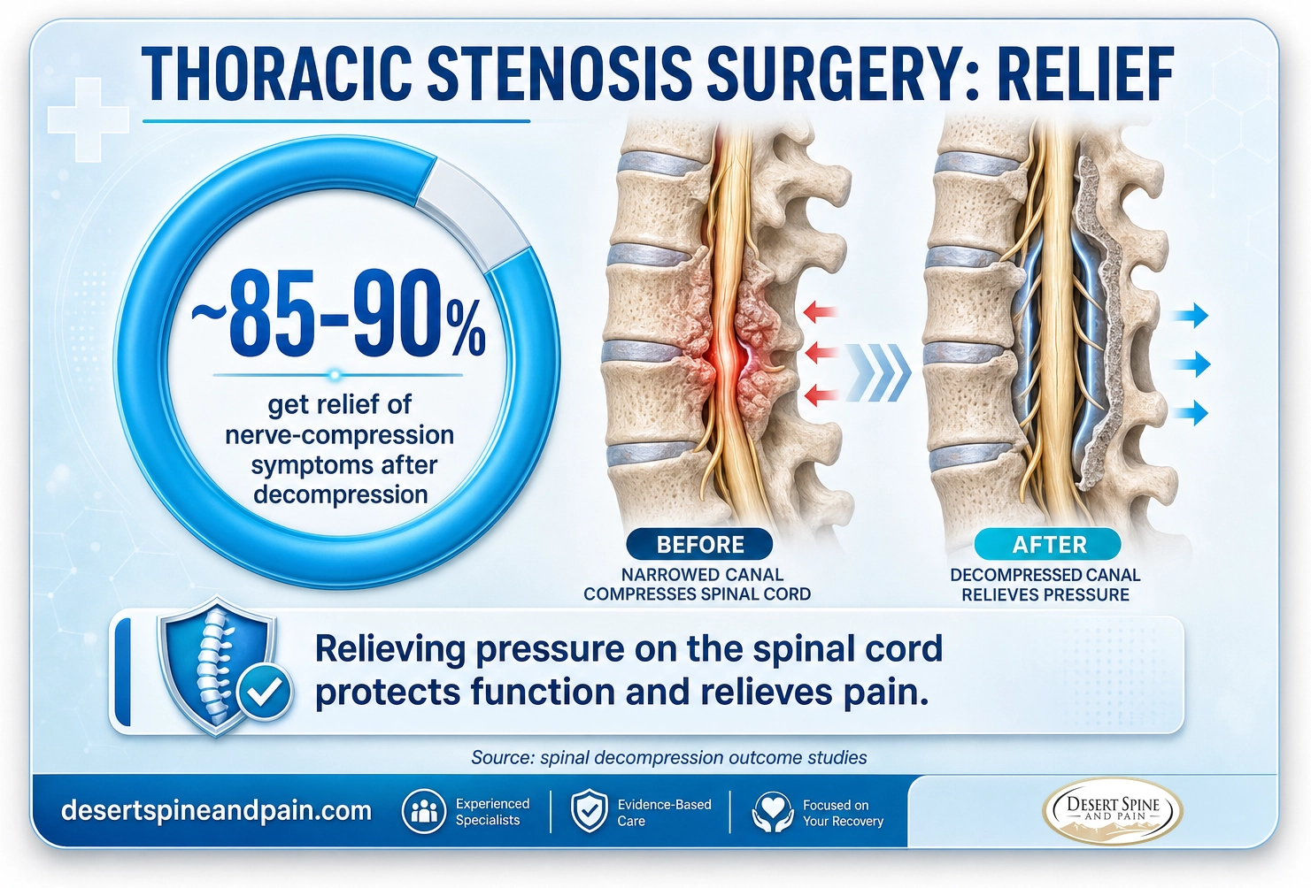 Thoracic stenosis surgery: about 85 to 90 percent get relief of nerve-compression symptoms after decompression