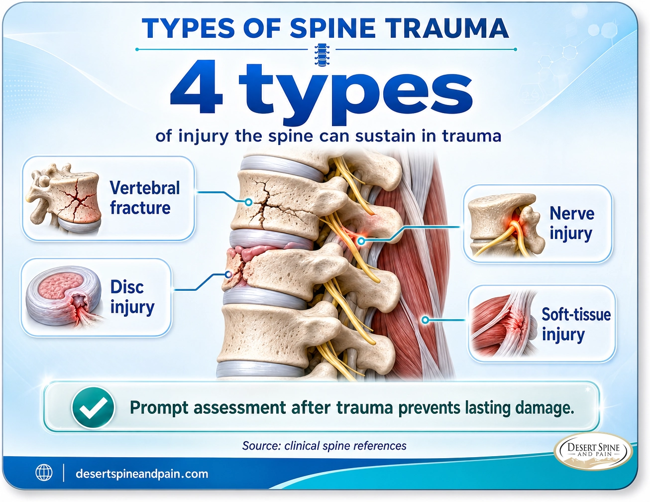 Types of spine trauma: vertebral fracture, disc injury, nerve injury, and soft-tissue injury