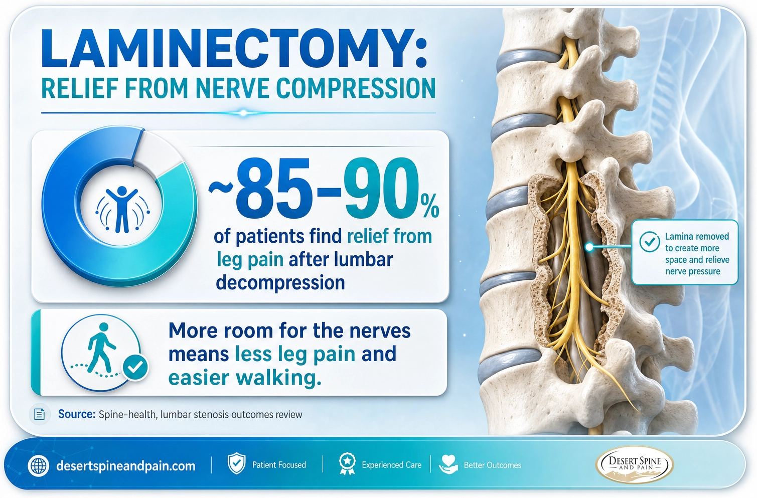 Laminectomy: about 85 to 90 percent of patients find relief from leg pain after lumbar decompression