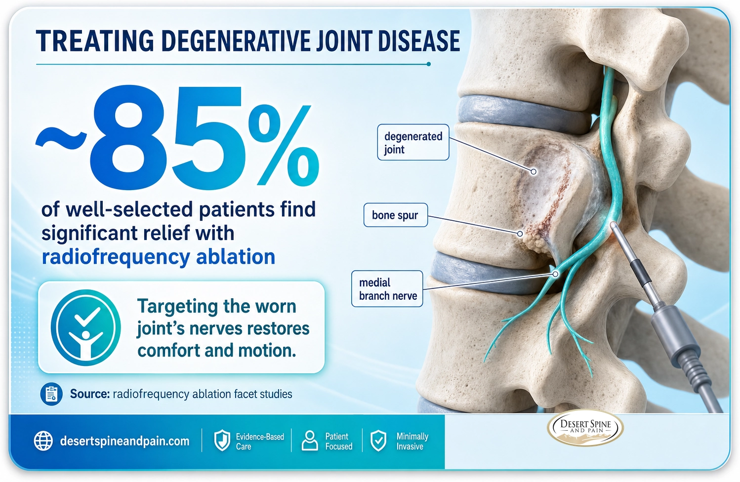 Degenerative joint disease: about 85 percent of well-selected patients find significant relief with radiofrequency ablation