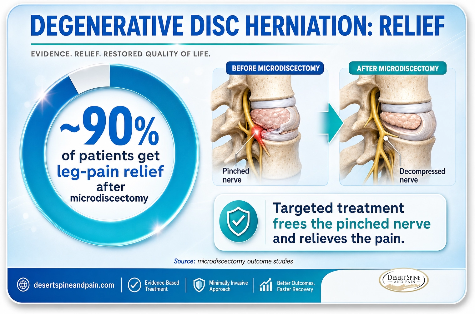 Degenerative disc herniation: about 90 percent of patients get leg-pain relief after microdiscectomy