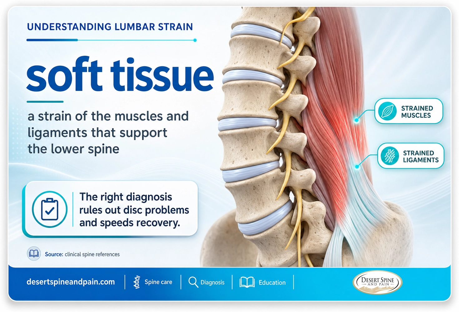 Lumbar strain: an injury of the muscles and ligaments supporting the lower spine, with the discs and nerves intact