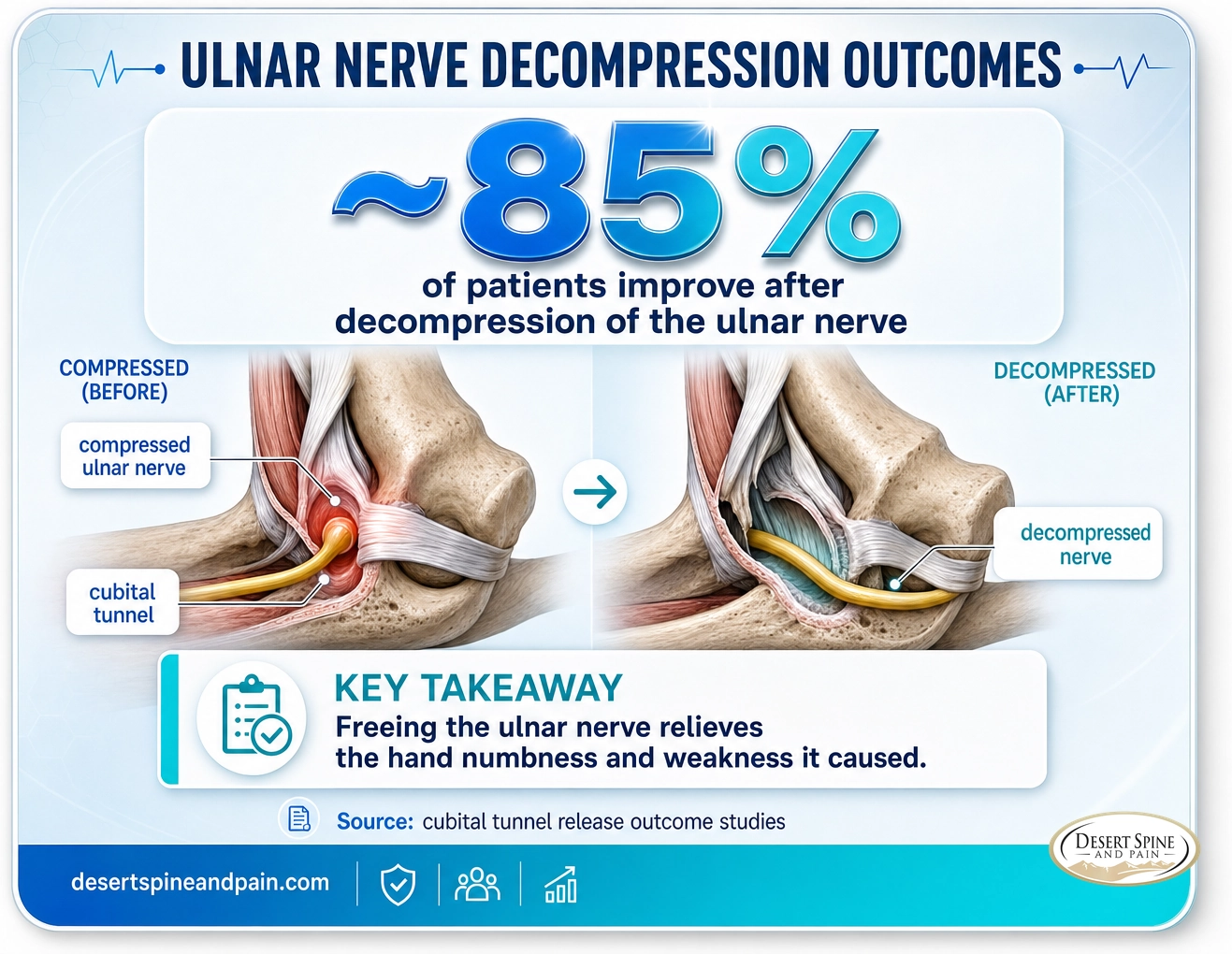 Ulnar nerve decompression: about 85 percent of patients improve after the nerve is freed