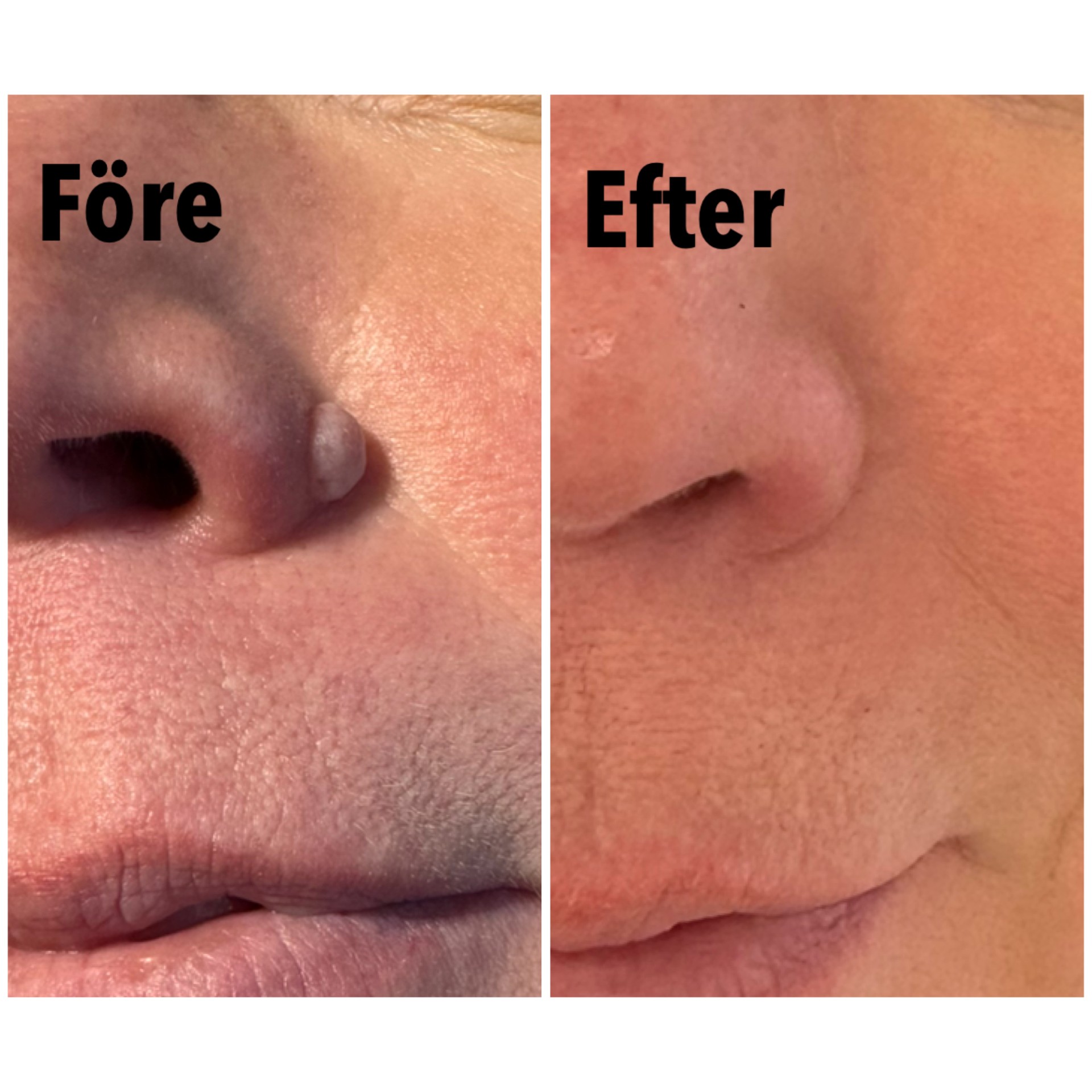 Före och efter – exempel 3