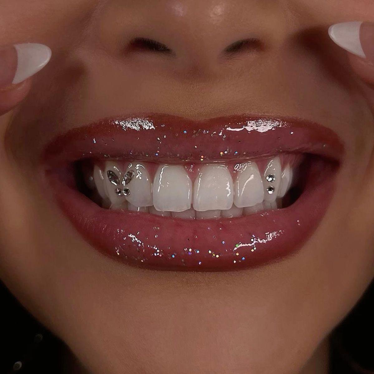 Auckland girl with very white teeth and tooth gems