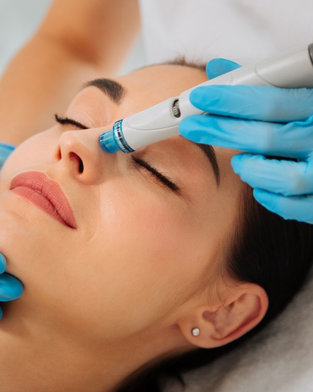 Woman getting hydrafacial in west auckland