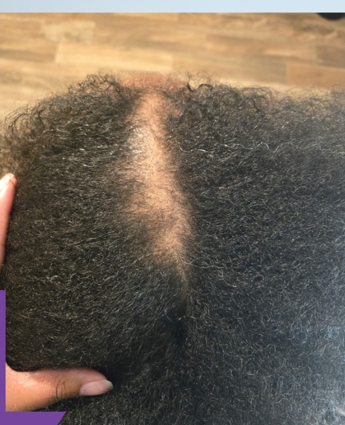 Client result example 10 before