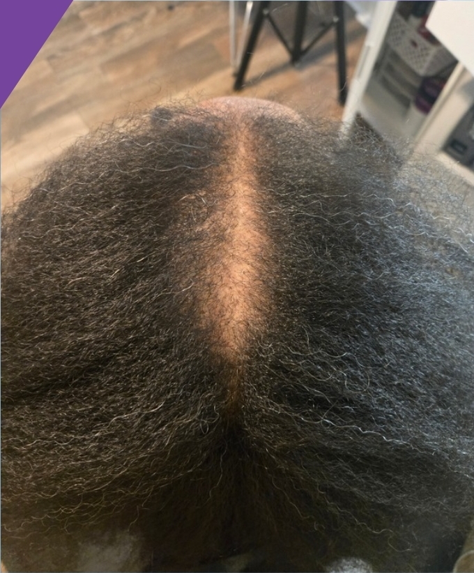 Client result example 10 after