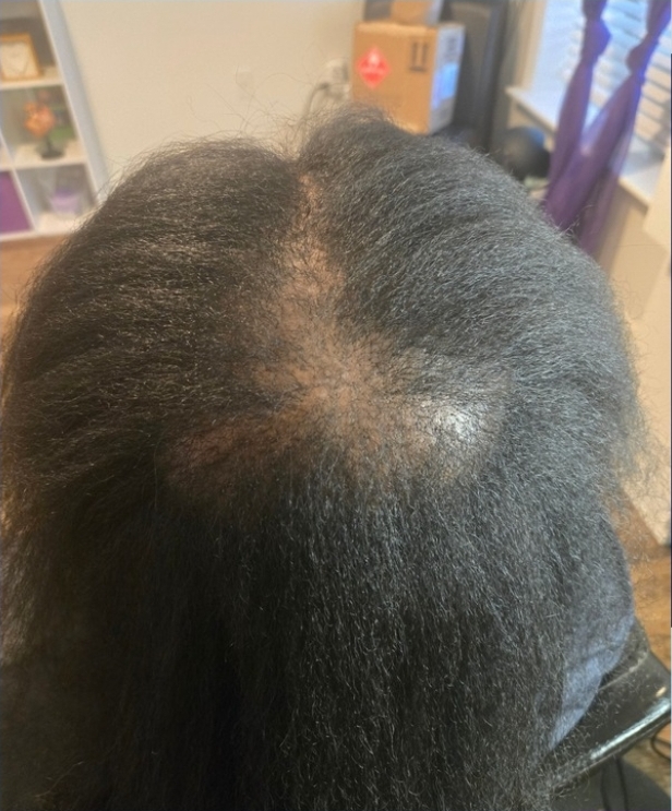 Client result example 6 before
