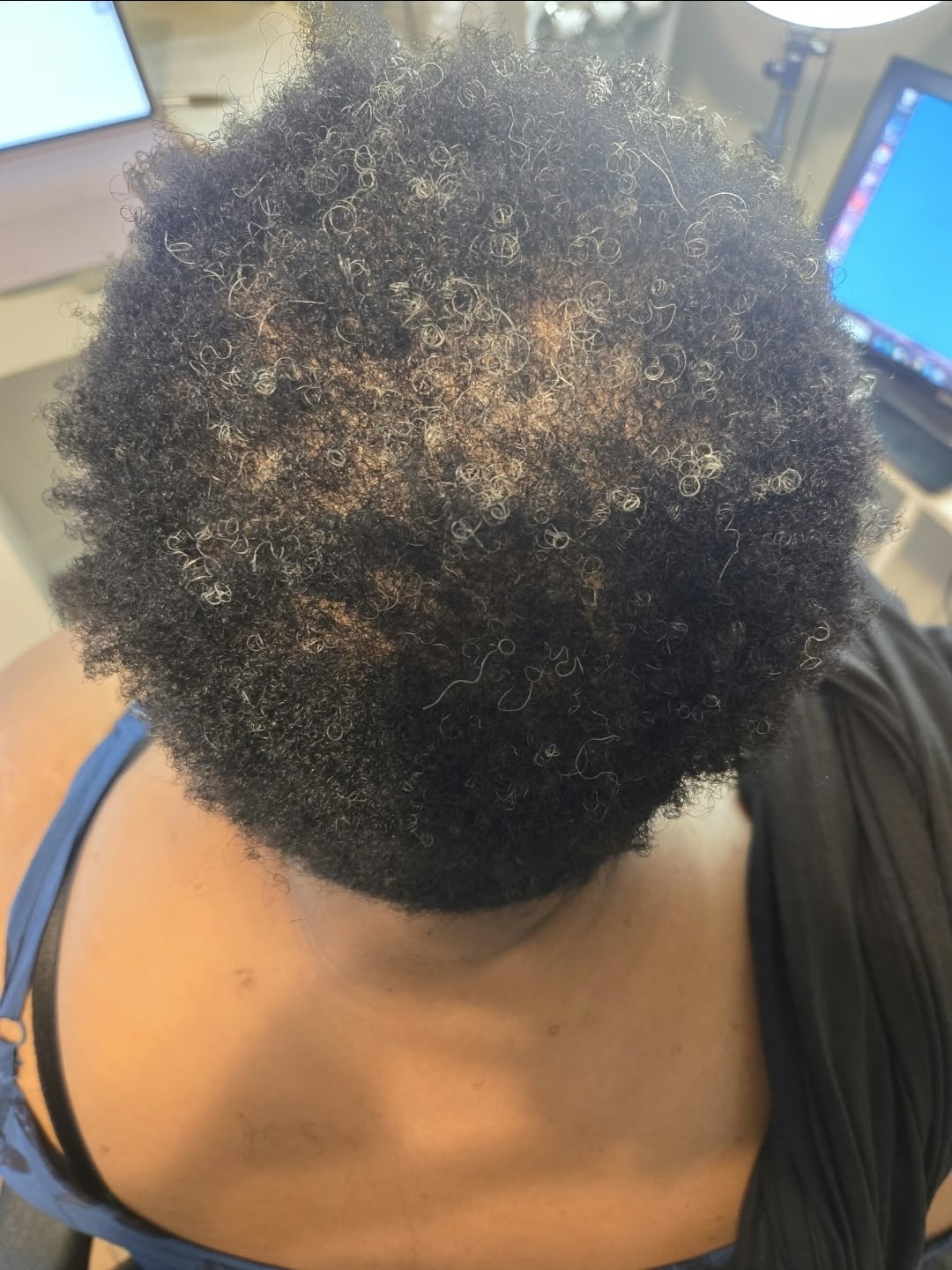 Client result example 7 before