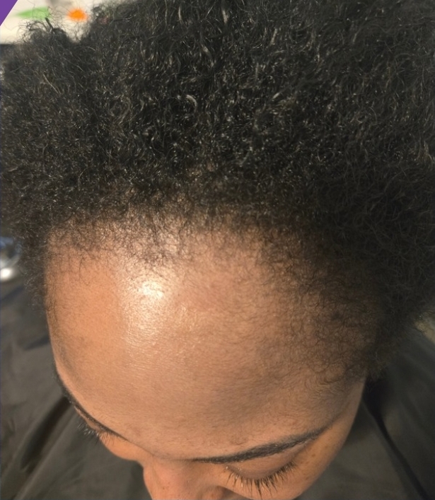 Client result example 5 after