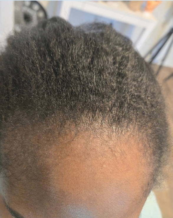 Client result example 5 before