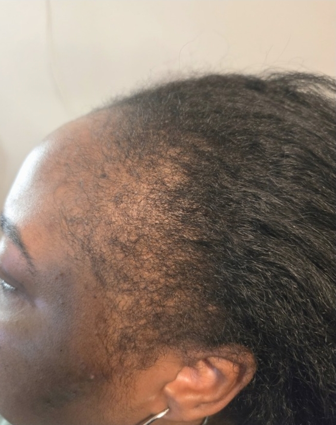Client result example 4 before
