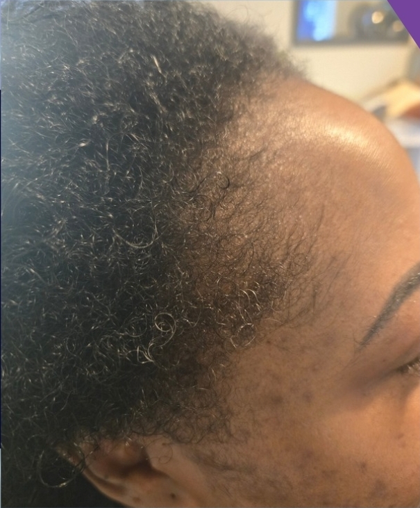 Client result example 3 after