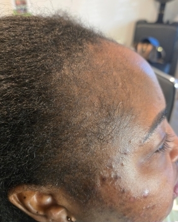Client result example 3 before