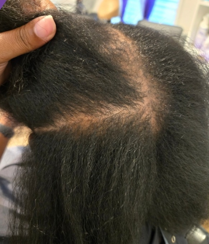 Client result example 2 before