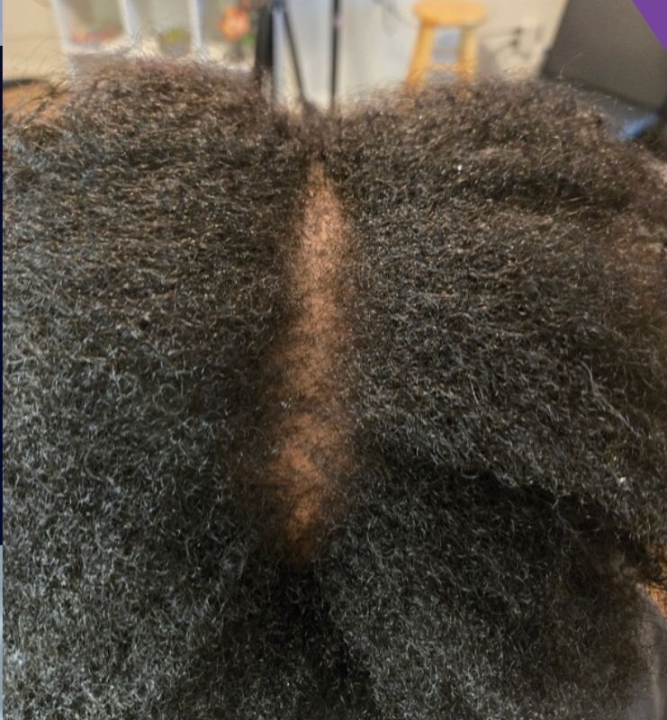 Client result example 1 after