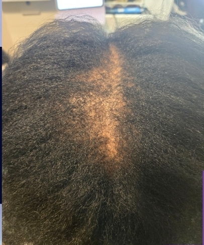 Client result example 1 before