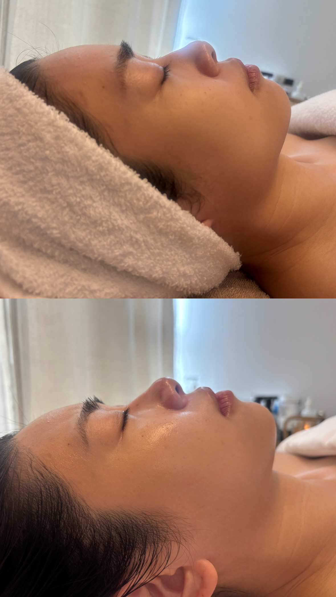 The Unwind Ritual — before and after facial treatment results