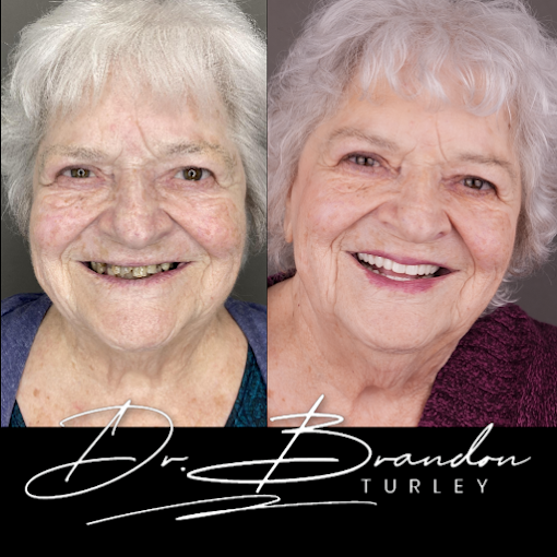 Before and after dental implant result