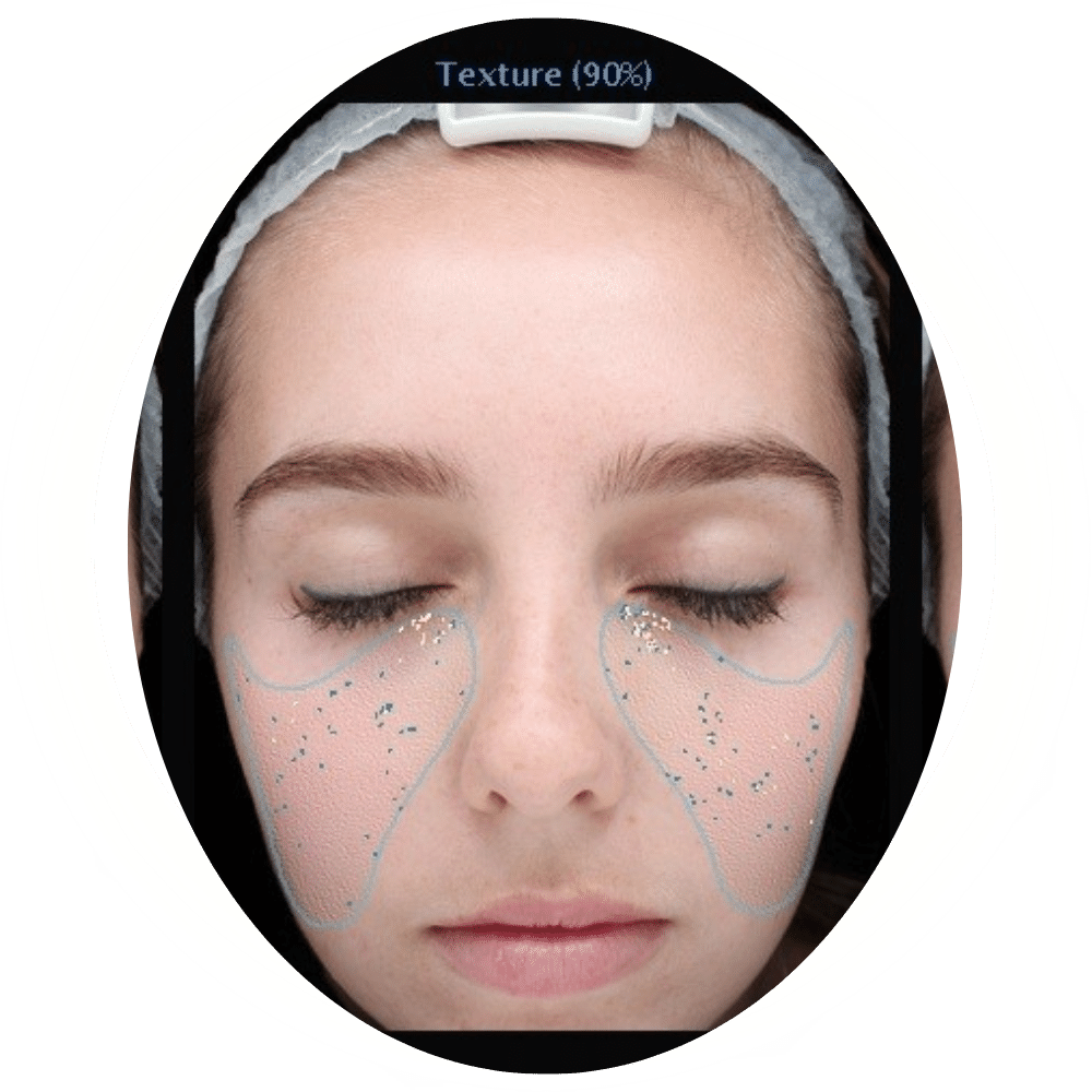 Skin Analysis 7